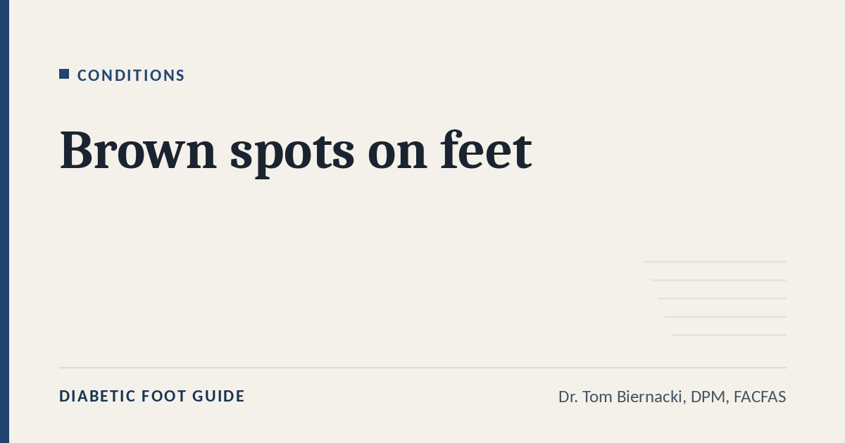 Diabetic Foot Guide article card: Brown spots on feet, in the Conditions series, by Dr. Tom Biernacki, DPM, FACFAS