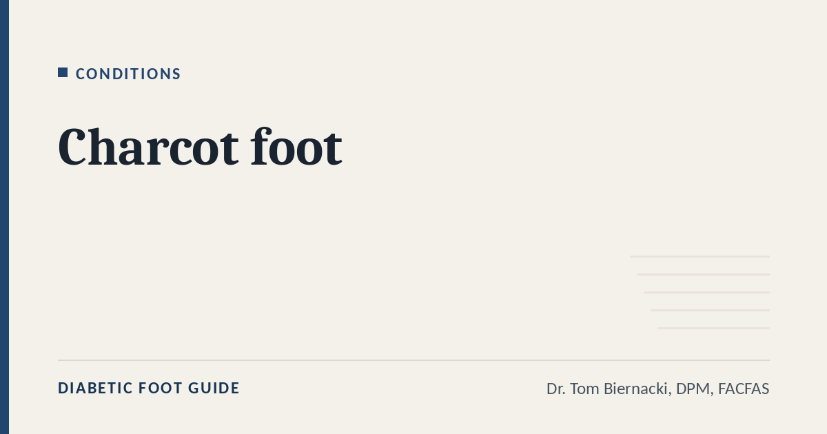 Diabetic Foot Guide article card: Charcot foot, in the Conditions series, by Dr. Tom Biernacki, DPM, FACFAS
