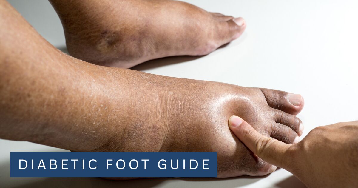A clinician examining the skin of a patient's foot and ankle for colour and texture changes